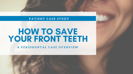 How To Save Your Front Teeth