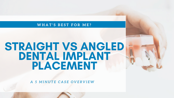 Clinical Case Study: Straight Versus Angled Dental Implant Placement